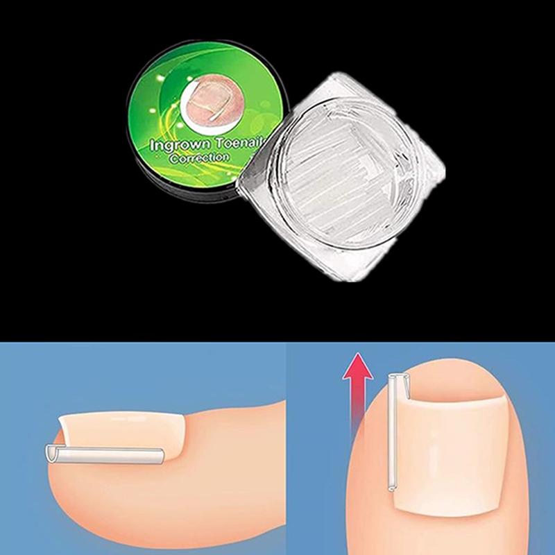 50 шт., инструмент для коррекции вросшего ногтя, лечение вросшего пальца, эластичная наклейка, выпрямляющий зажим, инструмент для педикюра