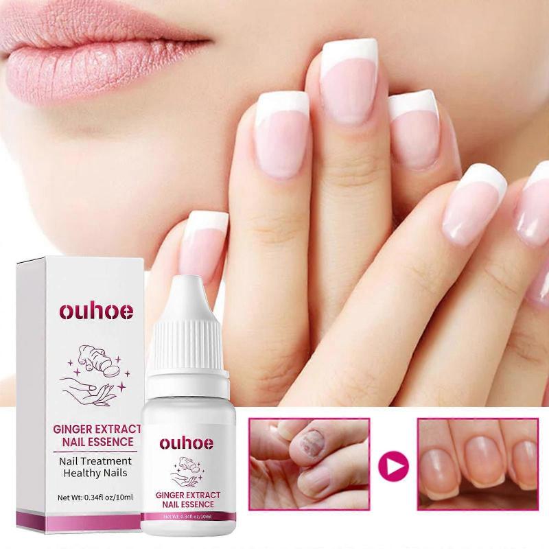 1-5x OUHOE Ginger Nail Care Essence, Gray Nail Moisturizing Care Exfoliating Beauty Nail Essence