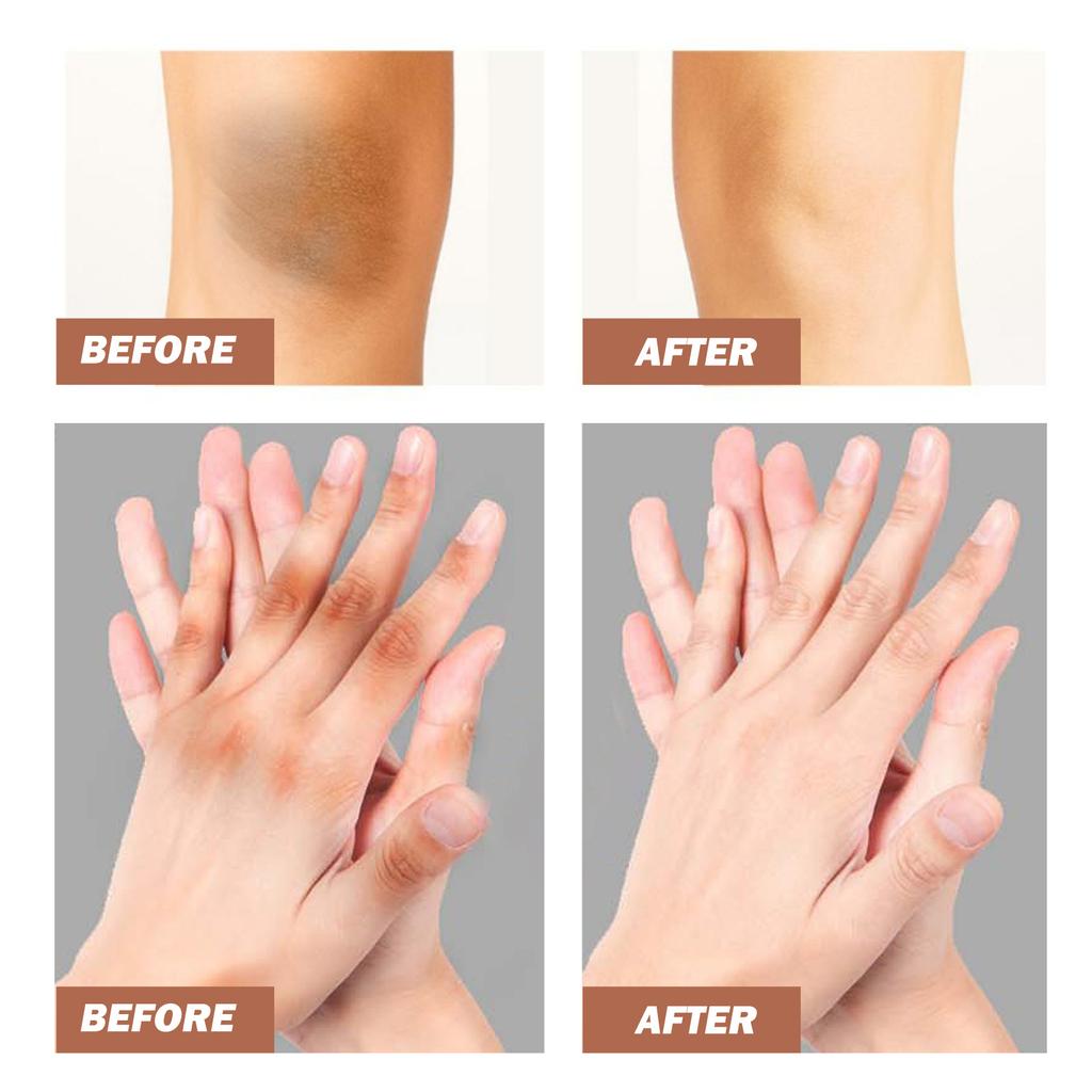 EELHOE Body Whitening Cream Fades Melanin Underarm Joints Elbow Improves Dullness Nourishes Brightening Skin Care 50g