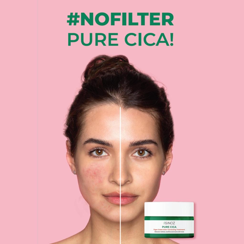 Sinoz Чистый Cica Тигровая трава Крем для коррекции цвета и восстановления – 15 мл