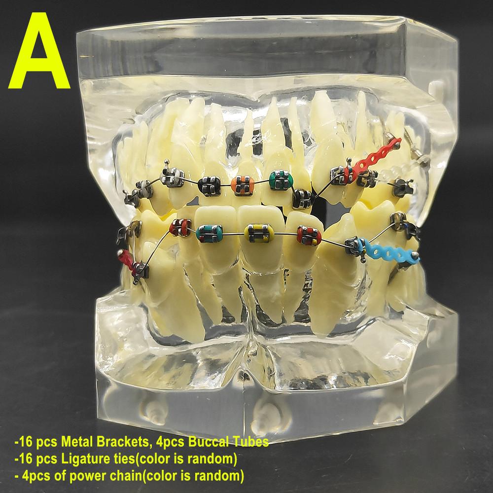 1 шт., прозрачная стоматологическая ортодонтическая модель прикуса с брекетами, буккальная трубка дуги для общения с пациентом