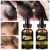 5ML/15ML/30ML/50ML/Hair Growth Serum Hair Care Product Hair Serum Fast Hair
