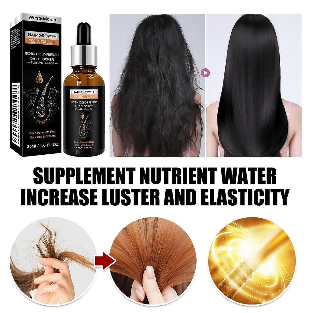 West&Month Hair Growth Essential Oil, Dense Hair Growth Repair Dry Hair And Moisture Hair Essence