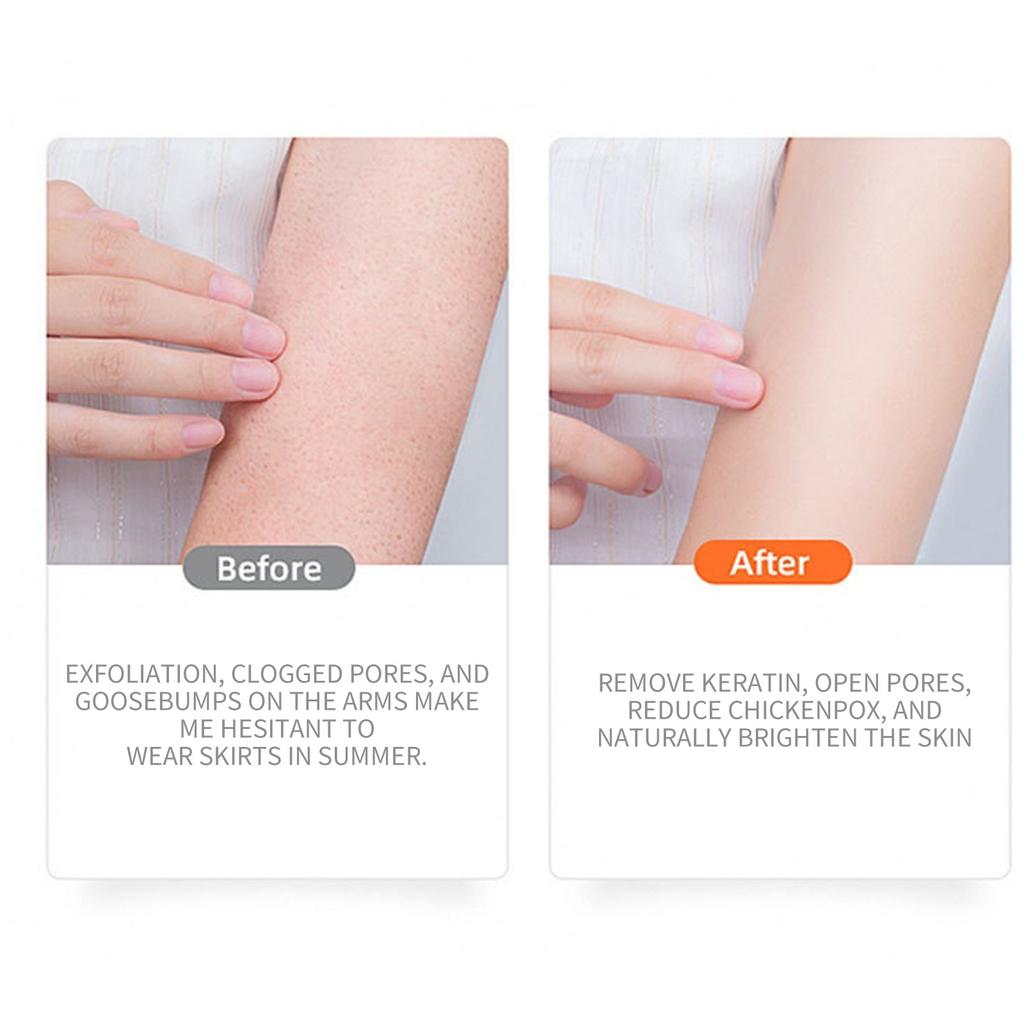 Lactoglucose Scrub Exfoliating Moisturizing Body Scrub Suitable For All Skin Types The Body Scrub Moisturizes The Skin And Leaves