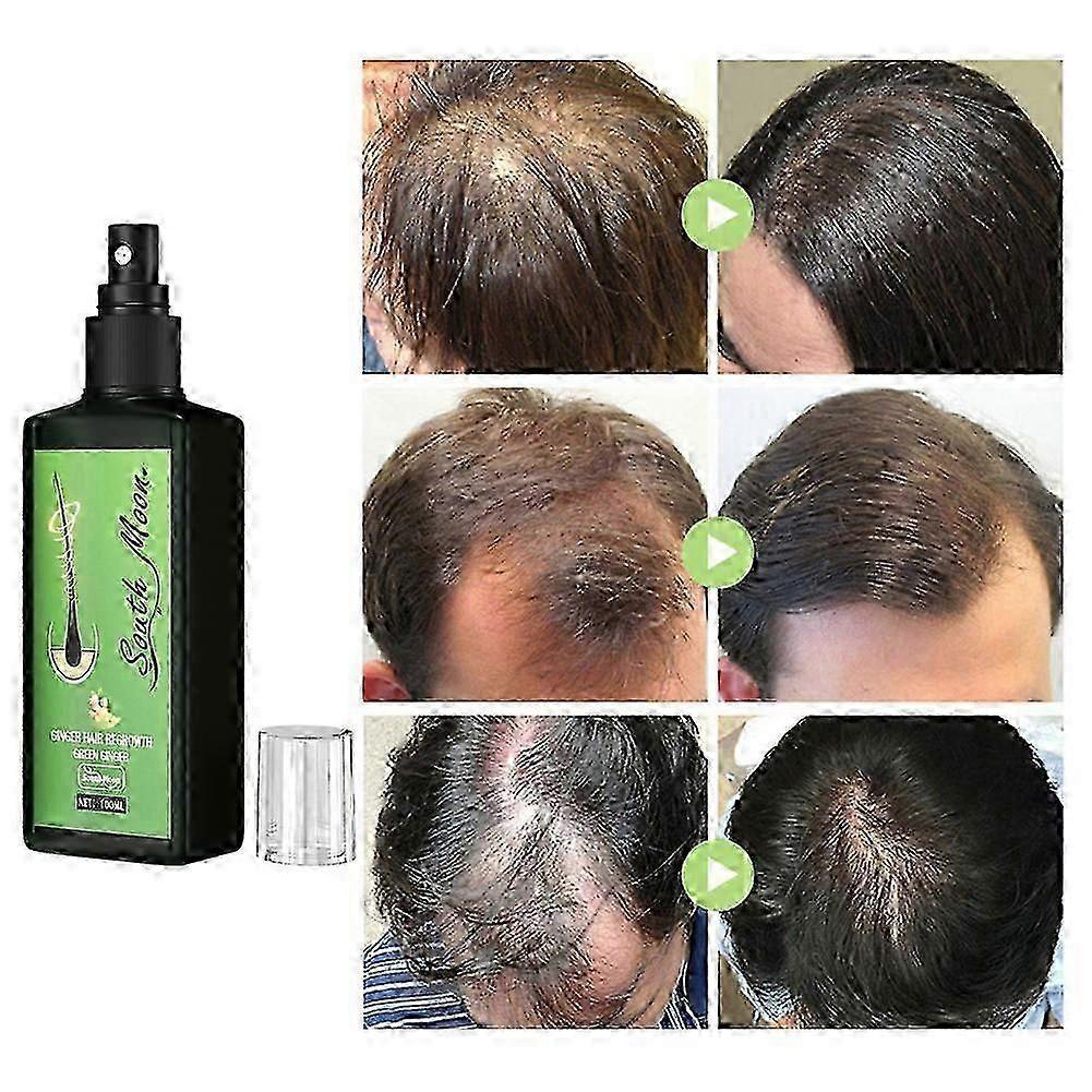 3Pcs Growth Nourishing Ginger Spray, Hair Growth Serum Spray Hair Lotion, Regrowth Nourishing Ginger Spray