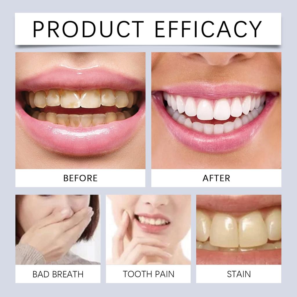 2 упаковки ручек для отбеливания зубов, эффективная чистка, отбеливающая ручка для чистки зубов, более красивая, 3 мл*2(1шт