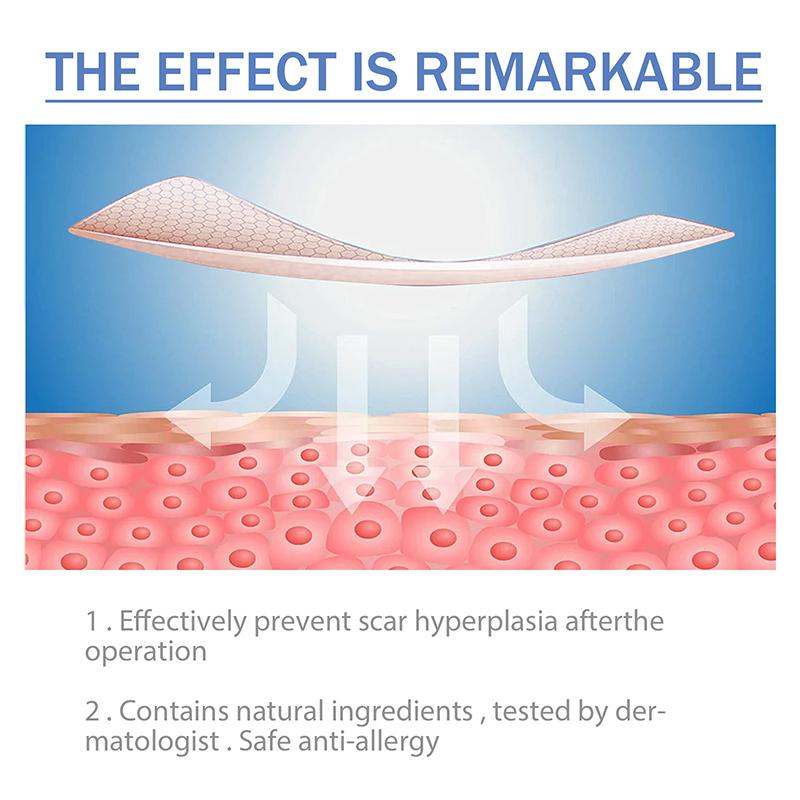 Силиконовые пластыри для рубцов, безболезненная лента для ремонта рубцов, рулон, эффективные полоски для удаления рубцов при кесаревом сечении, келоидная хирургия, ожоги, акне