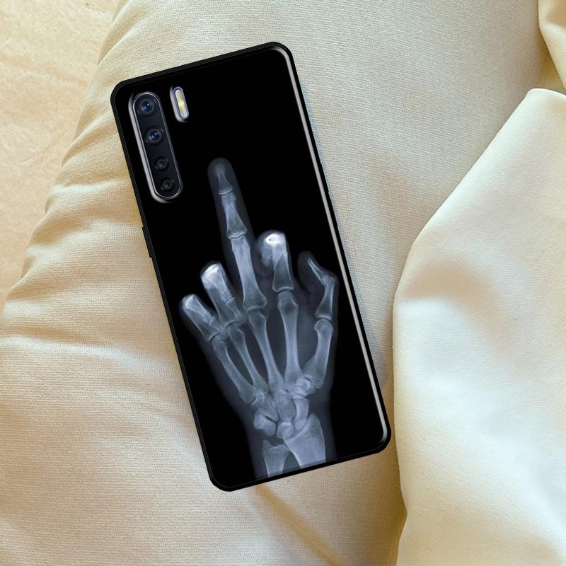 Чехол 'Скелет Средний палец' для Oppo A96 A76 A16 A18 A38 A58 A78 A98 A74 A94 A54 A80 A60 A40 A15 A17 A57 A5 A6 Pro