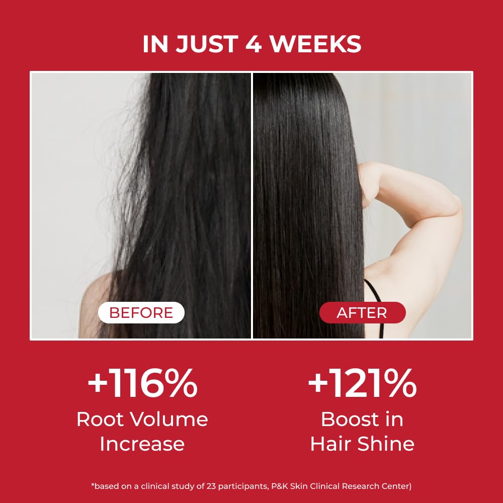 moev ANNURCATIN Шампунь Корейское яблоко Уход за волосами для силы и объема при истончении