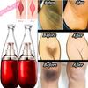 Women Private Part Pink Vaginal Lips Underarm Whitening Cream Dark Nipple Anal Bleaching Cream Brighten Skin Colour All Skin