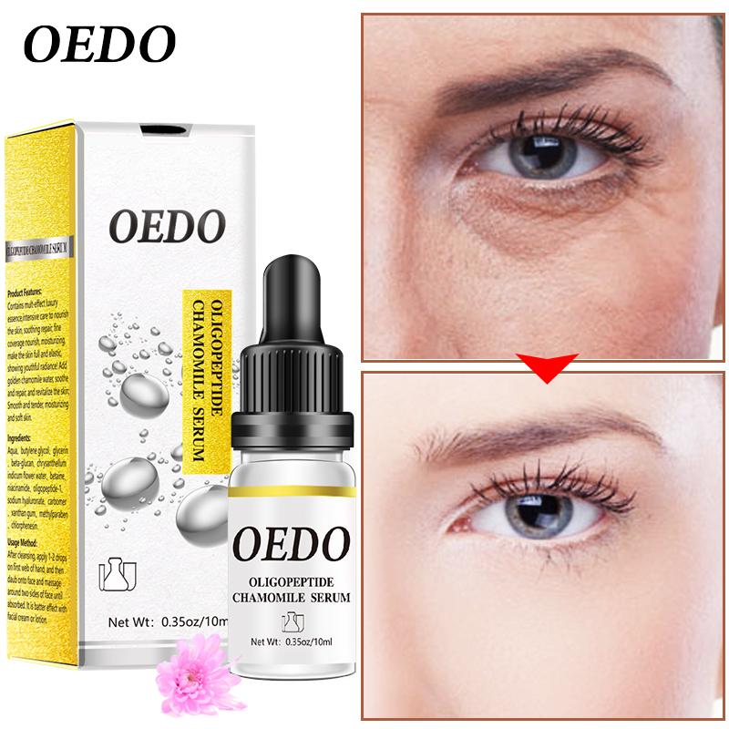 Олигопептидная сыворотка с ромашкой, увлажняющая эссенция, отбеливающая сыворотка против морщин для ухода за кожей лица, крем для лица от пятен
