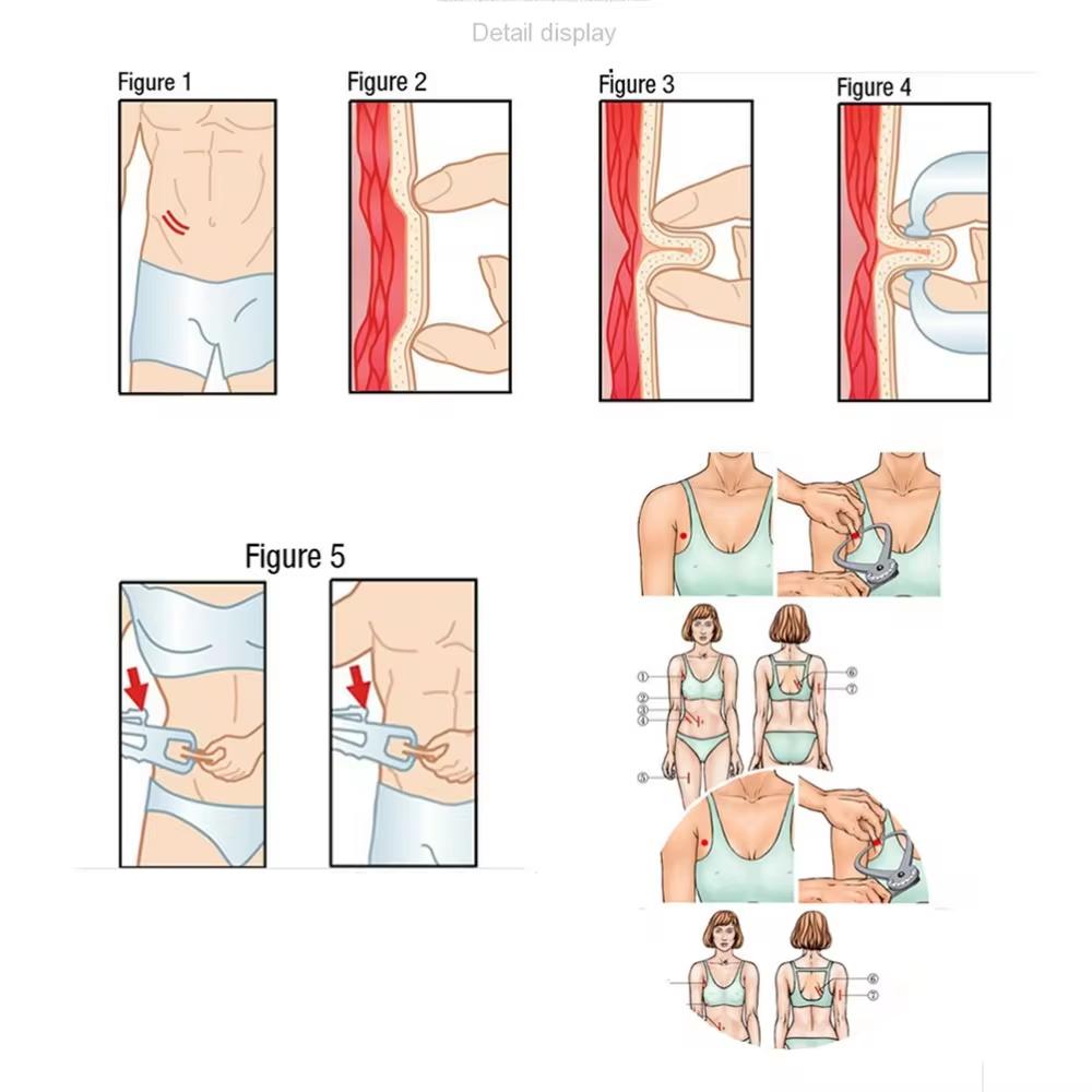 Кронциркуль для измерения жира Кронциркуль для измерения жира Линейка для измерения толщины жира в организме Кронциркуль для измерения потери веса Измерительный инструмент