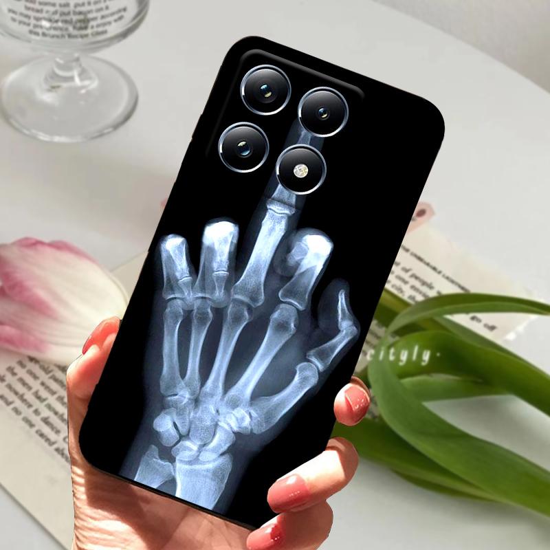 Чехлы Для Xiaomi 14T Бампер Оболочка Mi 14T Силиконовый Мягкий ТПУ Матовый Чехол Для Телефона Для Xiaomi 14T Pro 5G Милый Мультяшный Coque Funda Capa