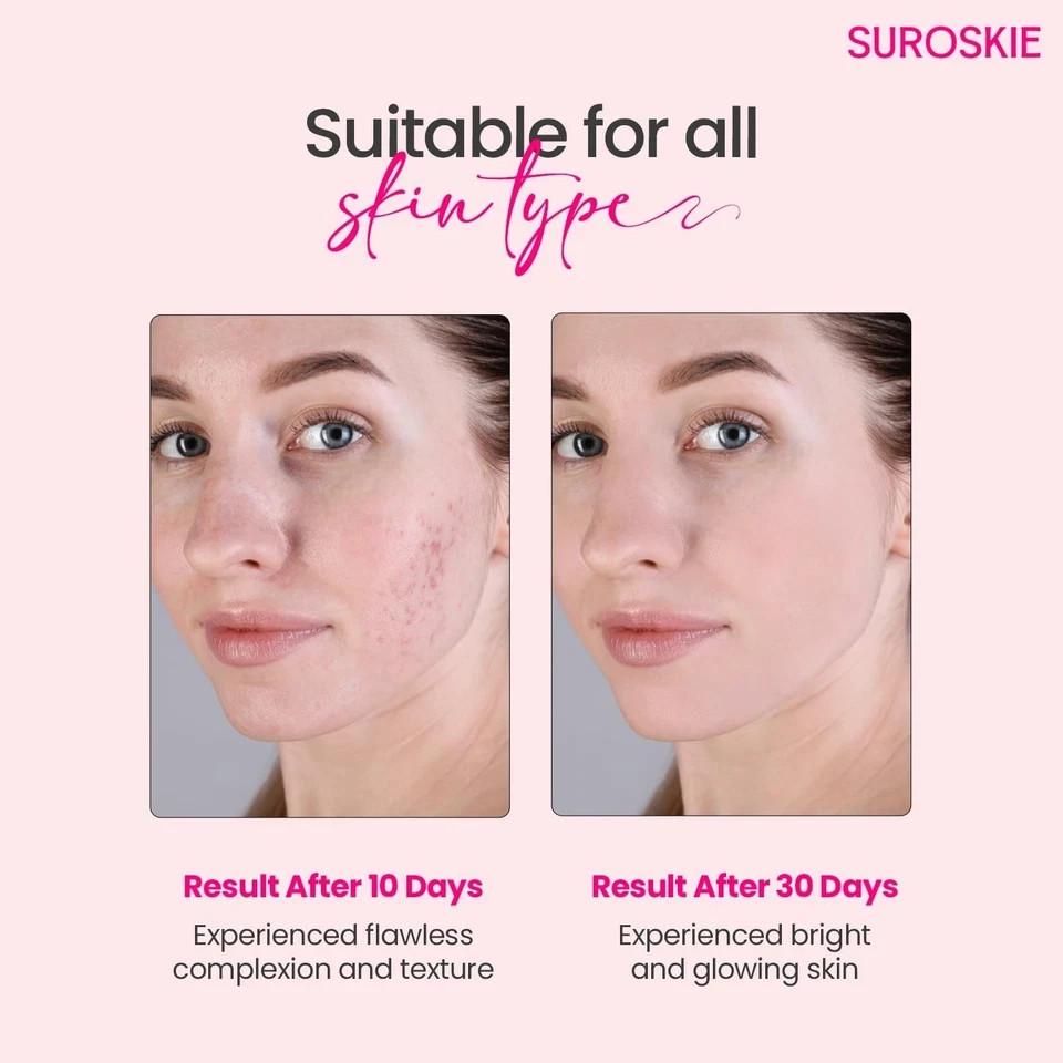SUROSKIE Rose Water Elixir Face Mist For Glowing, Refresh & Hydrating Skin 100ml