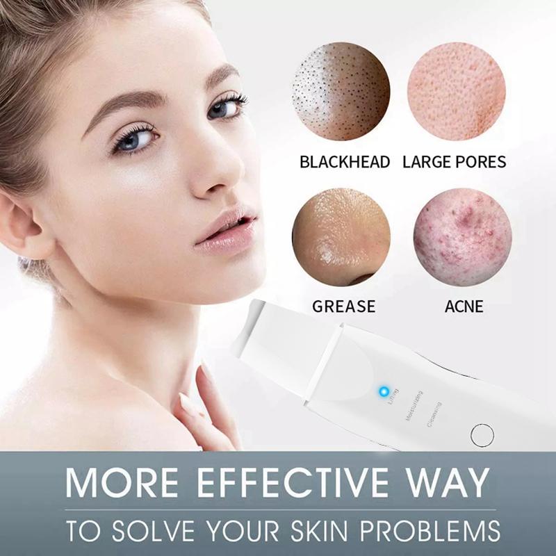 Blackhead Scraper Electric Pore Cleaner Acne Removal Exhaust Instrument Suction Wonder Ultrasonic Peeler