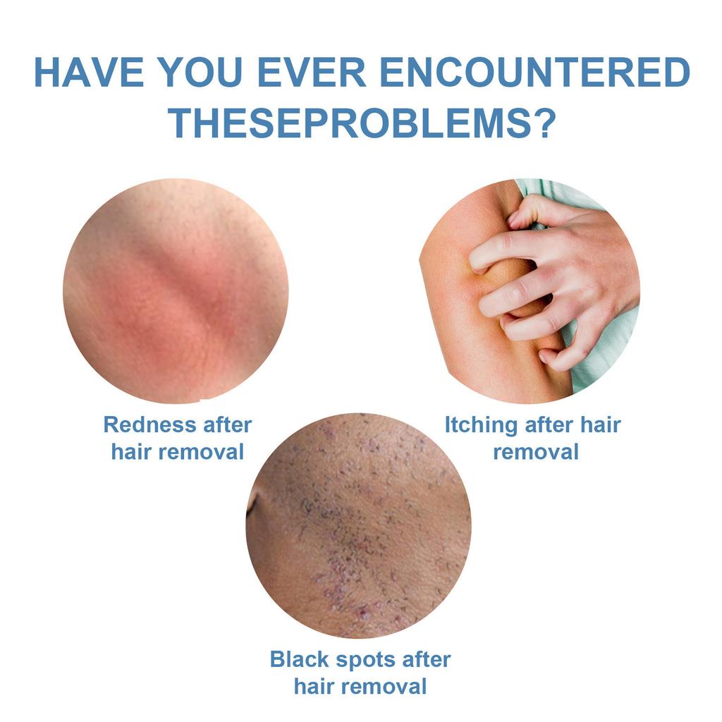 Эпиляция, эссенция для удаления волос останавливает удаление волос и облегчает увлажняющий крем для удаления волос 20 мл