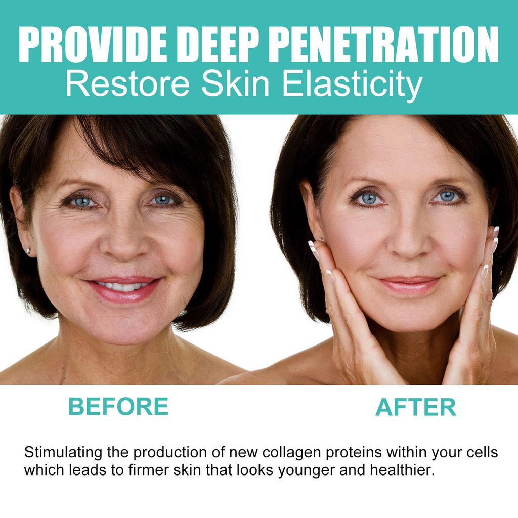 EELHOE Сыворотка для лица с гиалуроновой кислотой, увлажняющая, отбеливающая, укрепляющая, выцветает, тонкие линии, против морщин, против старения, эссенция для глубокого ухода, 30 мл