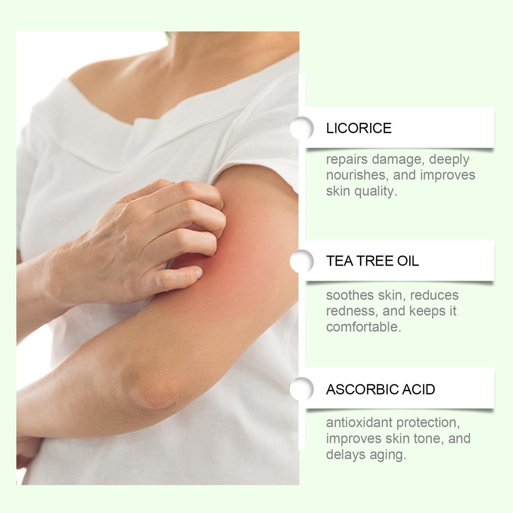 Противовоспалительный крем Крем для ухода за телом Увлажняющий травяной и зудящий увлажняющий уход за кожей Питательный крем