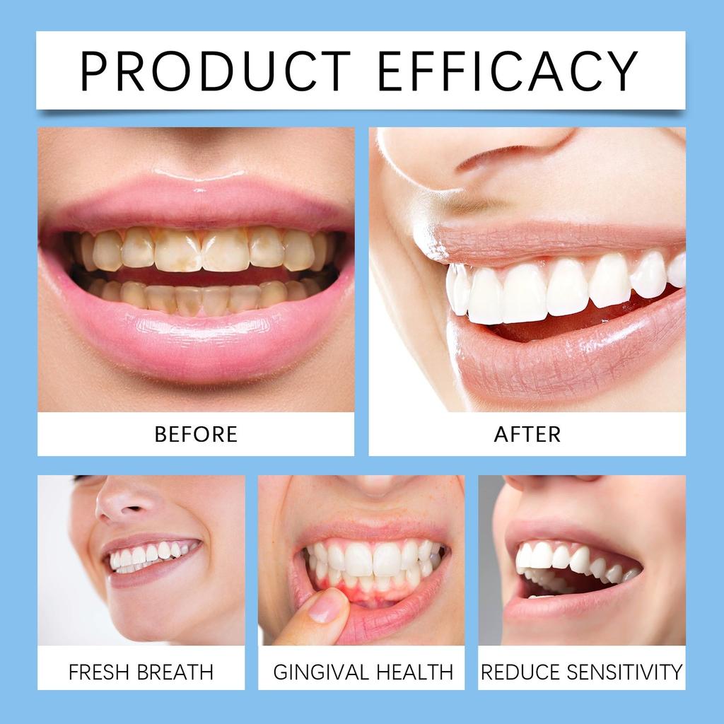 Oil Pulling With Oil With Tongue Scraper Inside The Box - Natural, Free Mouthwash To Help With Fresh Breath, Teeth Whitening And Healthier Teeth 100ml