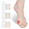 Инверсии и большого пальца ноги и мизинца одноразовый гидроколлоидный амортизационный фрикционный давление внутри 30 кейса для хранения TE302A [Профилактика вальгусной деформации,