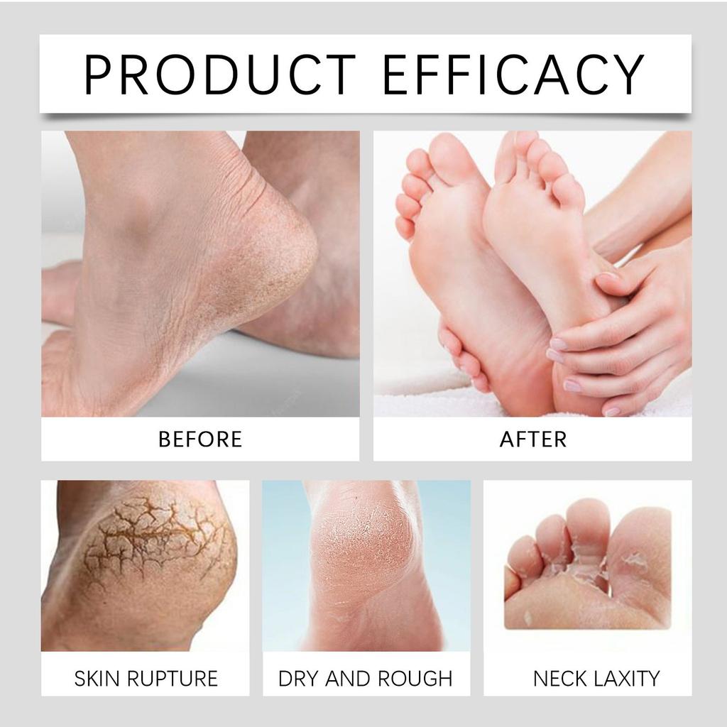 Спрей для ухода за ногами и успокаивающий спрей Мягко увлажняет и ухаживает за кожей ног, массирует подошву стопы, устраняя дискомфорт 20 мл