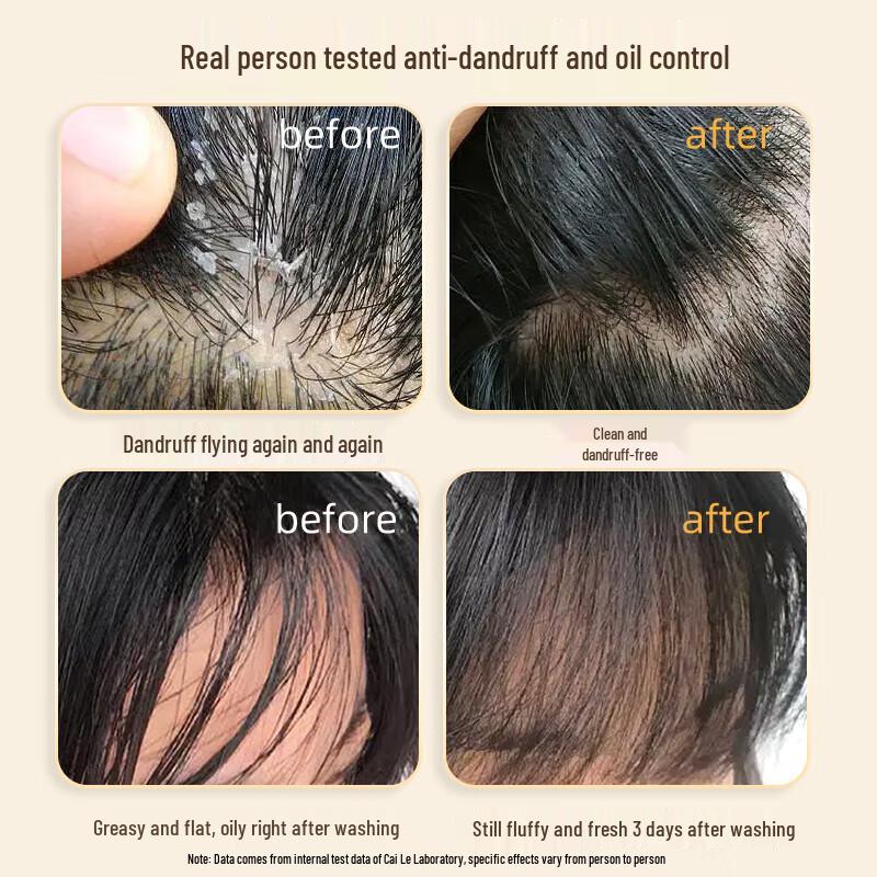 Cailuo White Truffle Oil Control Volumizing Shampoo