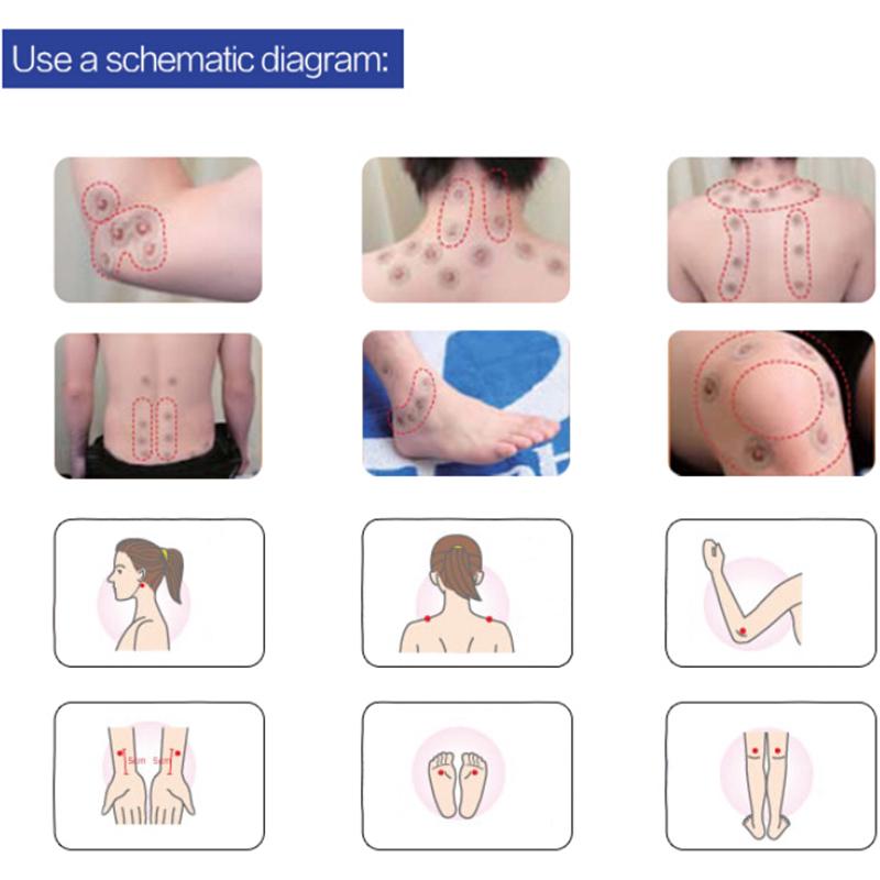 50 шт., титановая кинезиологическая лента, титановые диски, эластичная резинка для лечения боли в мышцах