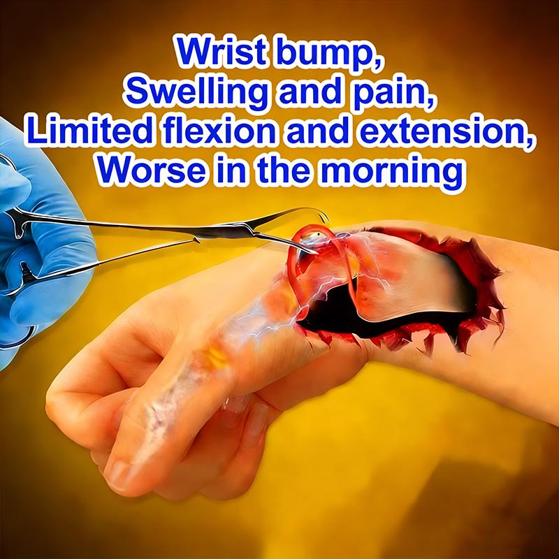 Тендинит Облегчение боли в суставах: При дискомфорте в большом пальце