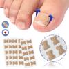 Sagit Glue-Free Orthopedic Patch For Toe Nail Ingrown Toenail Correction