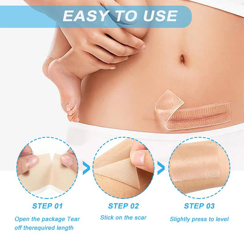 Professional Silicone Scar Sheets Scars Treatment Reusable Silicone Scar Strips Type For Keloid C-Section Surgery Burn