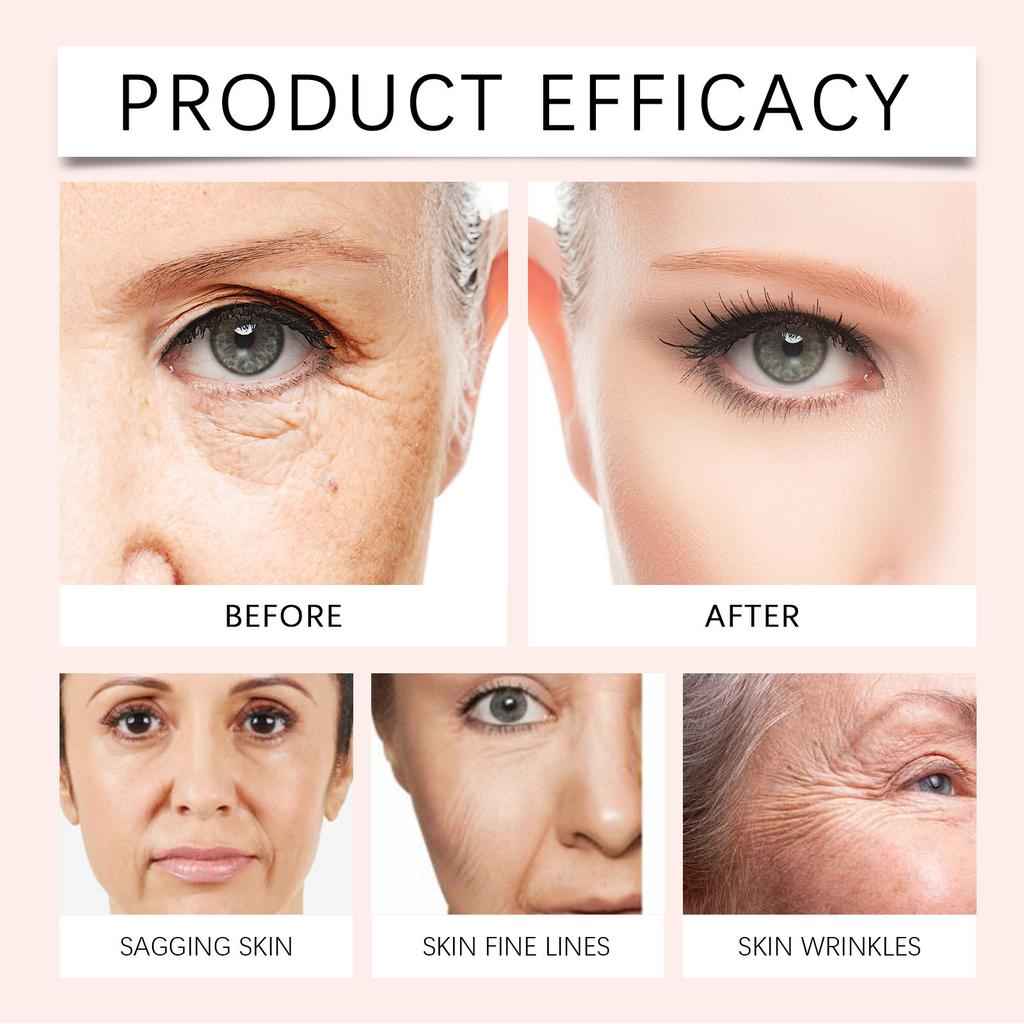 Укрепляющий крем для лица против морщин и старения питает и выравнивает тон кожи, подтягивает ее и омолаживает.