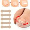 10Pcs Orthodontic Nail Patch Ingrown Armor and Grow Into Flesh Toe Pad Manicure Patch Orthosis