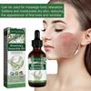 Rosemary Hair Growth Serum Anti Hair Loss Essential Oil Fast Regrowth