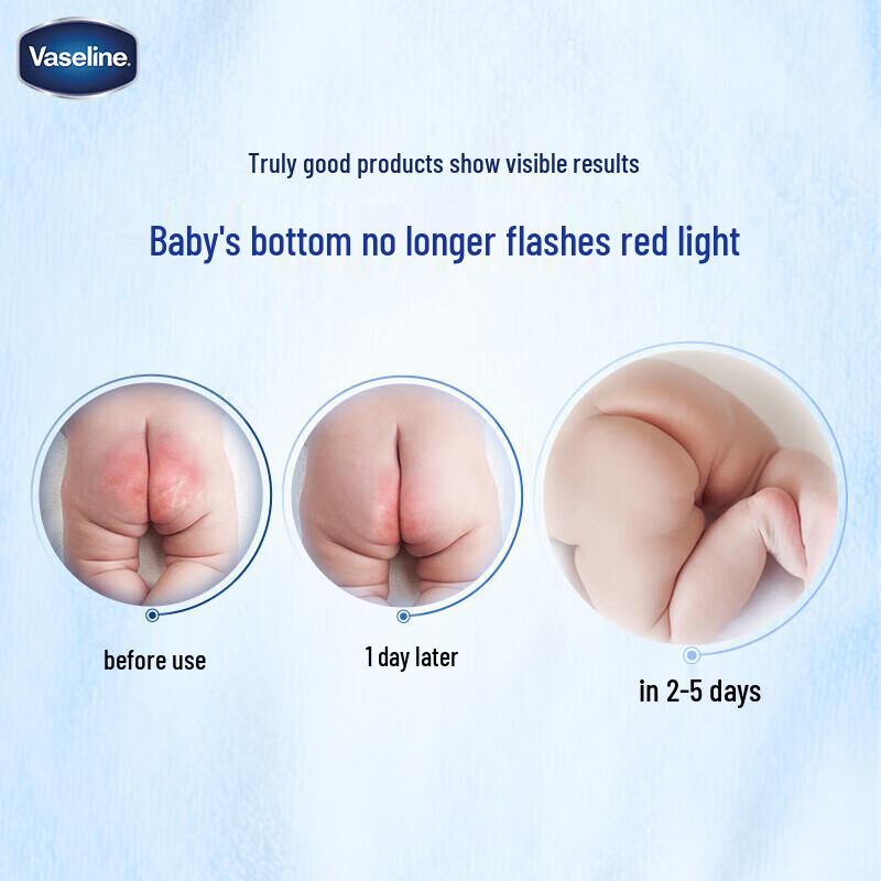 Vaseline Baby Repairing Petroleum Jelly (50g x 4-Pack)