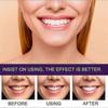 Eelhoe Purple Tooth Beautifying Toothpaste Niacinamide Whitening Yellow Tooth Remove Stains