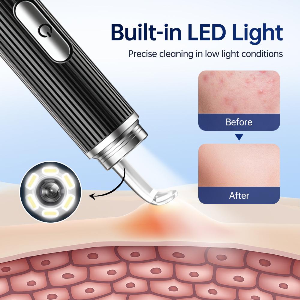 Визуальный очиститель от акне Электрический удалитель черных точек Очиститель пор Экстрактор угрей Инструменты для удаления дефектов Иглы Инструменты для удаления с HD-камерой