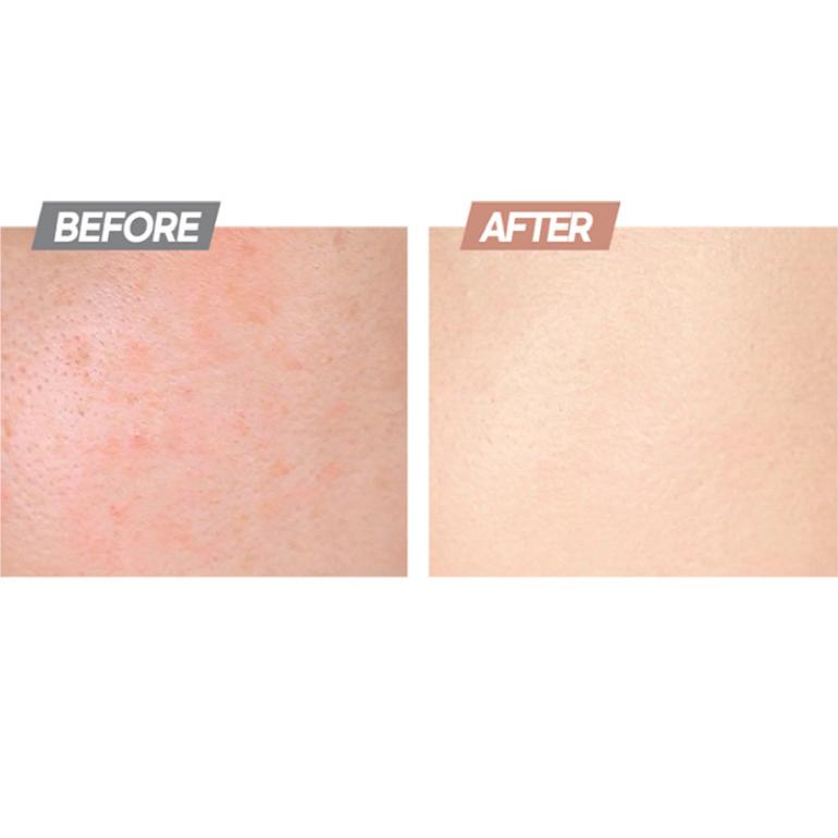 Age 20's Vita Осветляющий бальзам от пятен SPF50++PA++ 30мл