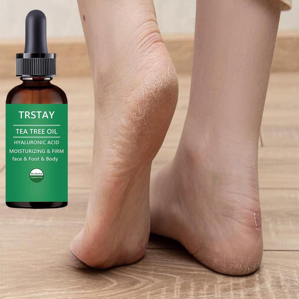 Лечение ног: Растительный лосьон для ног, увлажняющая эссенция для ухода за ногами для сухой кожи, потрескавшихся пяток, сильная целебная сила, противогрибковое средство