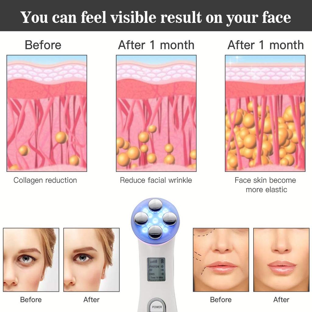 5 в 1 EMS Skin LED Фотонная подтяжка Мезотерапия Омоложение кожи лица Антивозрастной EMS Машина красоты Инструмент для ухода за кожей
