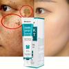 Whitening and Freckle Removal Cream, Lightening of Spots, Gentle Removal of Freckles, Age Spots and Chloasma Repairing Cream
