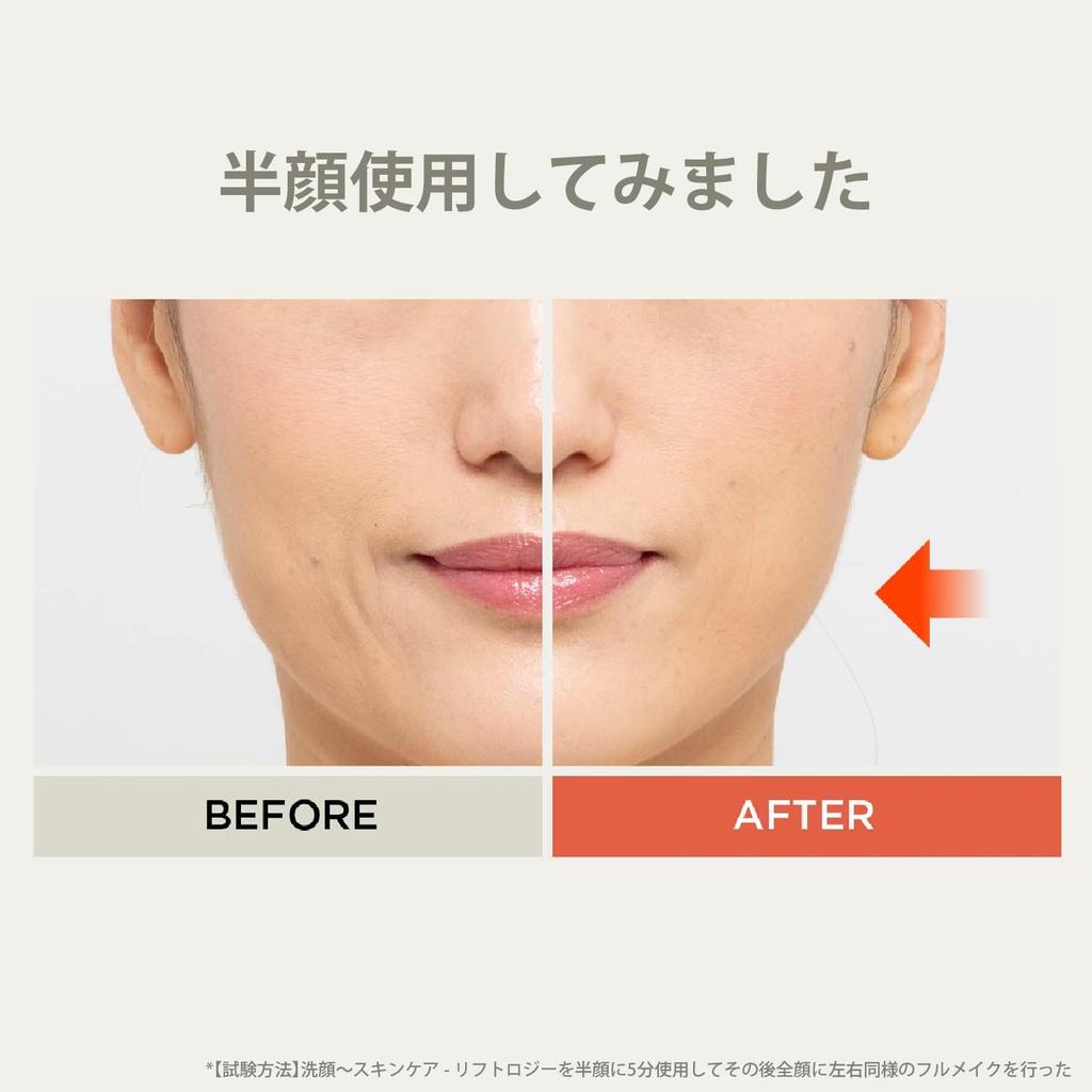 Аппарат для красоты лица Liftology Lift EMS YJFD1N Gold YA-MAN