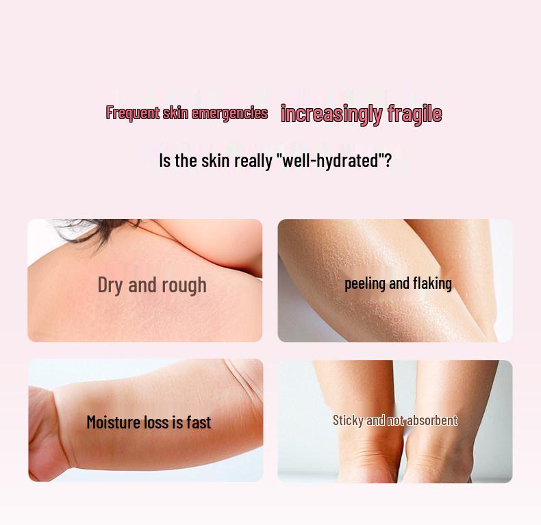 Johnson's Baby Moisturizing Oil for Newborn Massage and Skincare, Ideal for Cradle Cap and Blackheads.