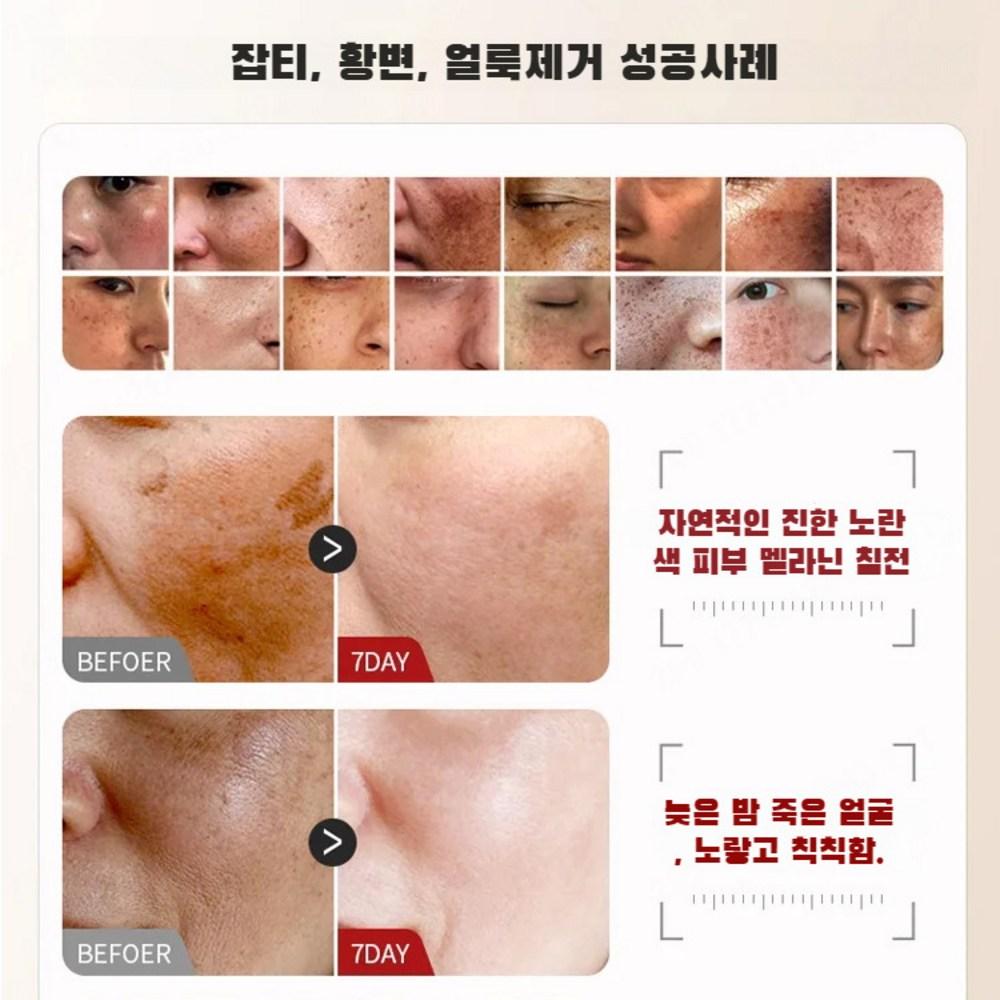 1+1 Whitening Spot Treatment Mask Moisture Sleep Mask Application Spot Suction Whitening Spot Mask, [1+1] 6gx10 Lines, 2 Pieces