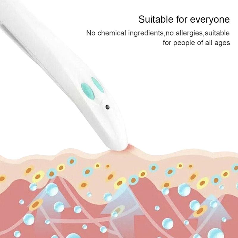 Electronic Mosquito Bite Antipruritic Device Portable Antipruritic Pen Mosquito Bite Antipruritic Device