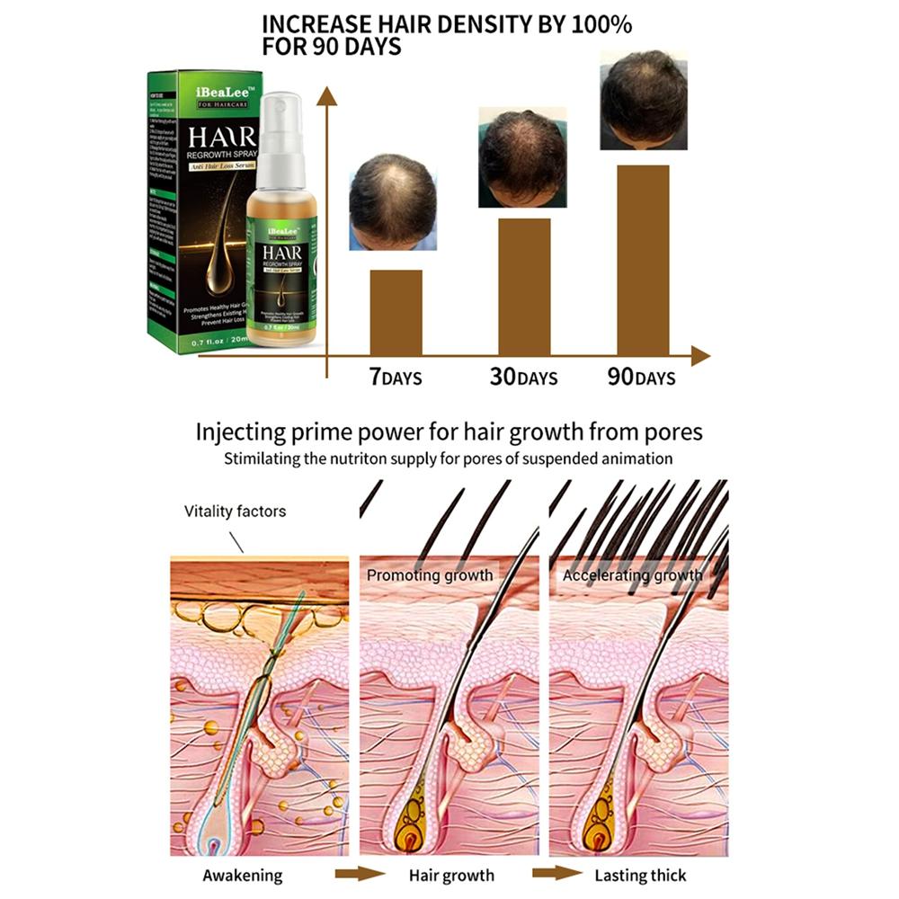 Спрей с эфирным маслом имбиря для роста волос для мужчин и женщин - 0,7 жидких унций