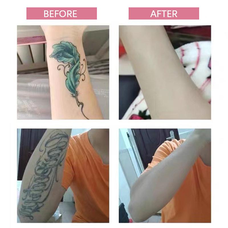 6Pcs Waterproof Tattoo Conceal Tape Full Cover Flaw Cover Sticker for Body Arm