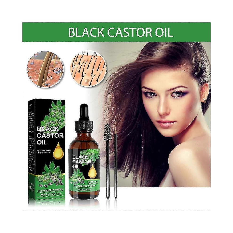Ouhoe Castor Oil Hair Serum Improves Hairline, Strengthens Hair, Nourishes Hair Roots, Softens Hair And Prevents Hair Loss -jxlgv |  |