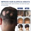 Крем Средства против выпадения волос Быстрорастущие Предотвращают сухость Пушистость Поврежденные Лечебное средство Уход за кожей головы Борода Мужчины Женщины 20 г