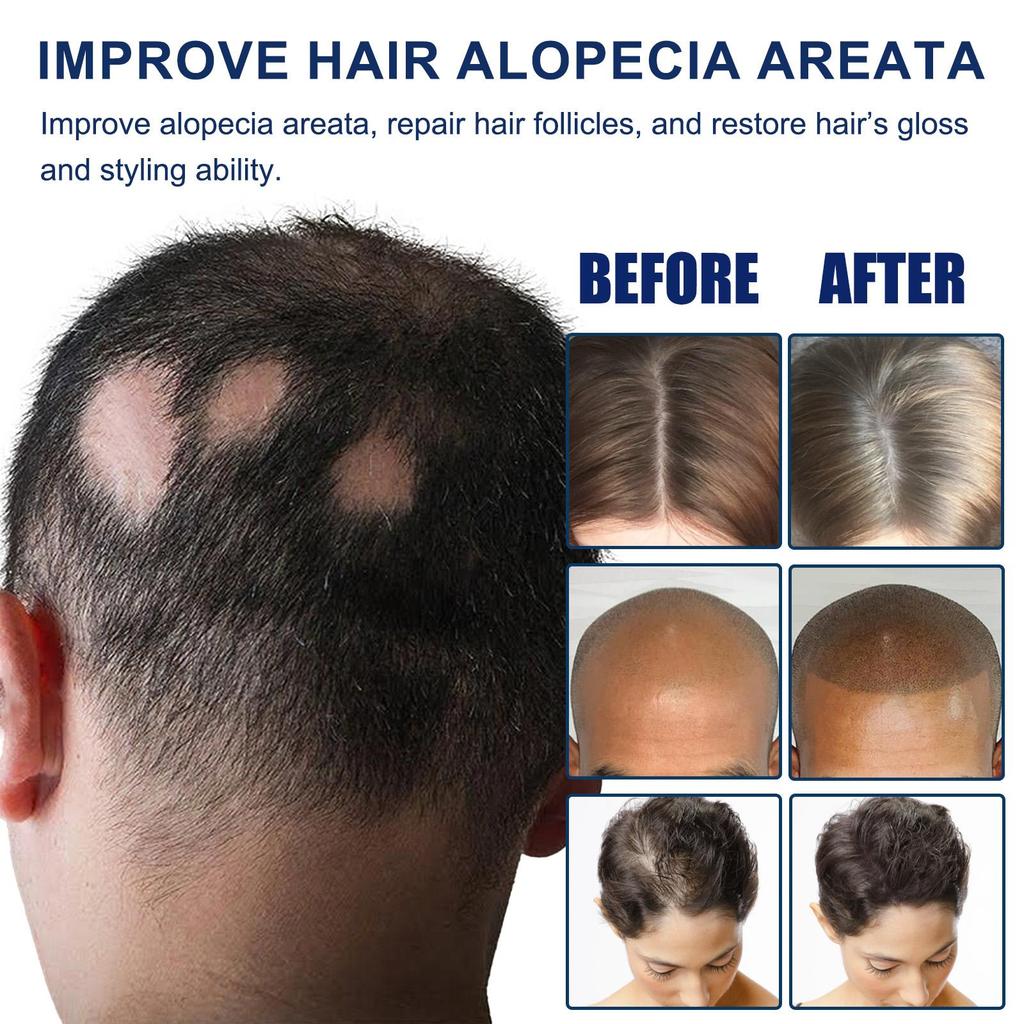 Крем Средства против выпадения волос Быстрорастущие Предотвращают сухость Пушистость Поврежденные Лечебное средство Уход за кожей головы Борода Мужчины Женщины 20 г