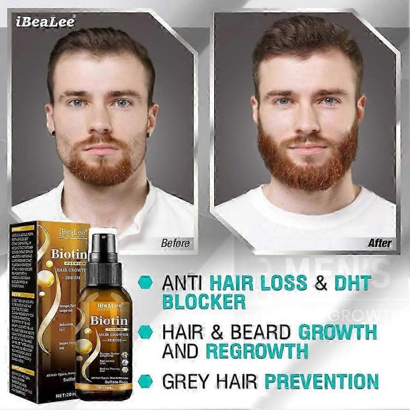 Спрей с биотином для роста волос, против выпадения волос, для быстрого роста, сыворотка для лечения кожи головы
